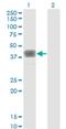 MAGE Family Member B1 antibody, H00004112-M01, Novus Biologicals, Western Blot image 