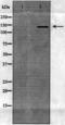 ATP Binding Cassette Subfamily B Member 1 antibody, MBS857847, MyBioSource, Immunohistochemistry paraffin image 