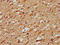 Delta Like Canonical Notch Ligand 3 antibody, LS-C372215, Lifespan Biosciences, Immunohistochemistry paraffin image 