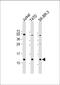 Trefoil factor 1 antibody, M01391-2, Boster Biological Technology, Western Blot image 