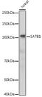 SATB Homeobox 1 antibody, GTX55787, GeneTex, Western Blot image 