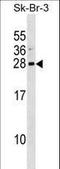 ADP Ribosylation Factor Like GTPase 1 antibody, LS-C156487, Lifespan Biosciences, Western Blot image 