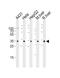 Cytochrome B5 Reductase 3 antibody, PA5-72179, Invitrogen Antibodies, Western Blot image 