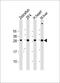 Adenylate Kinase 2 antibody, LS-C392743, Lifespan Biosciences, Western Blot image 
