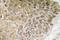 Phosphoinositide-3-Kinase Regulatory Subunit 1 antibody, LS-C177719, Lifespan Biosciences, Immunohistochemistry paraffin image 