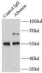 ALB antibody, FNab00279, FineTest, Immunoprecipitation image 