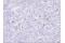 TNF Receptor Superfamily Member 9 antibody, 34594S, Cell Signaling Technology, Immunohistochemistry paraffin image 