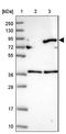 Glucuronidase Beta antibody, NBP2-38293, Novus Biologicals, Western Blot image 