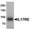 Interleukin 17 Receptor E antibody, PA5-34499, Invitrogen Antibodies, Western Blot image 