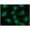 Proteasome 26S Subunit, Non-ATPase 10 antibody, GTX57642, GeneTex, Immunocytochemistry image 