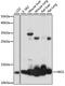 Hemoglobin Subunit Gamma 1 antibody, A02830, Boster Biological Technology, Western Blot image 