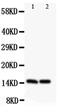 Homeobox A1 antibody, PA5-79386, Invitrogen Antibodies, Western Blot image 