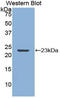 Matrix Metallopeptidase 12 antibody, LS-C314498, Lifespan Biosciences, Western Blot image 