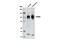 Discs Large MAGUK Scaffold Protein 2 antibody, 9445S, Cell Signaling Technology, Western Blot image 