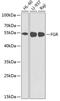 FGR Proto-Oncogene, Src Family Tyrosine Kinase antibody, GTX32602, GeneTex, Western Blot image 