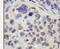 Ubiquitin Specific Peptidase 8 antibody, PA5-12004, Invitrogen Antibodies, Immunohistochemistry paraffin image 