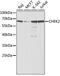Checkpoint Kinase 2 antibody, 13-179, ProSci, Western Blot image 