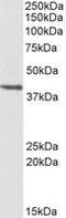 Proteasome Subunit Beta 7 antibody, MBS422454, MyBioSource, Western Blot image 