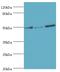 Protein Tyrosine Phosphatase Non-Receptor Type 1 antibody, MBS968910, MyBioSource, Western Blot image 