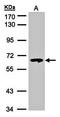 Cytosolic beta-glucosidase antibody, orb73377, Biorbyt, Western Blot image 