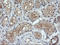 Parvin Alpha antibody, LS-C174641, Lifespan Biosciences, Immunohistochemistry paraffin image 