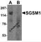 Small G Protein Signaling Modulator 1 antibody, 7033, ProSci Inc, Western Blot image 