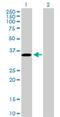 Protein C Receptor antibody, H00010544-D01P, Novus Biologicals, Western Blot image 