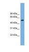 Tubulin beta-4 chain antibody, NBP1-57005, Novus Biologicals, Western Blot image 