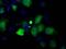 Profilin 1 antibody, MA5-25113, Invitrogen Antibodies, Immunocytochemistry image 