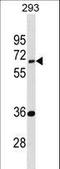 Enhancer Of MRNA Decapping 3 antibody, LS-C157702, Lifespan Biosciences, Western Blot image 