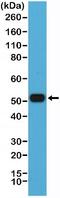 Interferon Regulatory Factor 4 antibody, NBP2-77422, Novus Biologicals, Western Blot image 