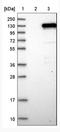 Zinc Finger CCCH-Type Containing 11A antibody, NBP1-82974, Novus Biologicals, Western Blot image 