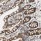 KH Domain Containing 4, Pre-MRNA Splicing Factor antibody, NBP1-86485, Novus Biologicals, Immunohistochemistry frozen image 