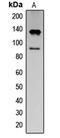 Interferon Alpha And Beta Receptor Subunit 1 antibody, GTX32330, GeneTex, Western Blot image 