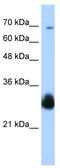 Ring Finger Protein 138 antibody, TA331919, Origene, Western Blot image 