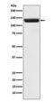 Zinc Finger Protein 217 antibody, M03921-2, Boster Biological Technology, Western Blot image 