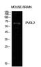 Nectin Cell Adhesion Molecule 2 antibody, A08081, Boster Biological Technology, Western Blot image 