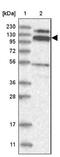 RNA Binding Motif Protein 15B antibody, NBP1-81650, Novus Biologicals, Western Blot image 