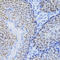 Minichromosome Maintenance Complex Component 4 antibody, 18-908, ProSci, Immunohistochemistry paraffin image 