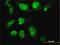Homeobox D11 antibody, H00003237-M10, Novus Biologicals, Immunocytochemistry image 
