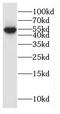 Glycine Receptor Alpha 3 antibody, FNab03488, FineTest, Western Blot image 