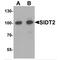 SID1 Transmembrane Family Member 2 antibody, MBS153631, MyBioSource, Western Blot image 