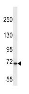 Kallikrein B1 antibody, abx027801, Abbexa, Western Blot image 