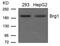 SWI/SNF Related, Matrix Associated, Actin Dependent Regulator Of Chromatin, Subfamily A, Member 4 antibody, 79-761, ProSci, Western Blot image 