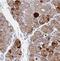 Transmembrane and coiled-coil domains protein 1 antibody, NBP2-30463, Novus Biologicals, Immunohistochemistry paraffin image 