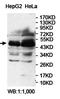 CD13 antibody, orb78211, Biorbyt, Western Blot image 