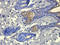 ATPase Family AAA Domain Containing 2 antibody, orb31113, Biorbyt, Immunohistochemistry paraffin image 