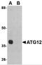 Autophagy Related 12 antibody, 4423, ProSci, Western Blot image 