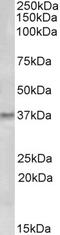 GTP Cyclohydrolase 1 antibody, LS-C87242, Lifespan Biosciences, Western Blot image 