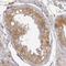 Inhibitor Of Nuclear Factor Kappa B Kinase Subunit Beta antibody, NBP1-87699, Novus Biologicals, Immunohistochemistry paraffin image 